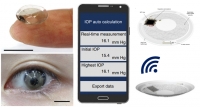 **[2021] A Soft and Transparent Contact Lens for the Wireless Quantitative Monitoring of Intraocular Pressure