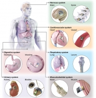[2024] Bioelectronic Implantable Devices for Physiological Signal Recording and Closed-Loop Neuromodulation