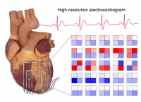 [2024] Three-dimensional Electrodes of Liquid Metals for Long-term, Wireless Cardiac Analysis and Modulation