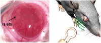 *[2020] Intraocular pressure monitoring following Islet transplantation to the anterior chamber of the eye