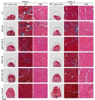 [2025] Acoustofluidic bioassembly induced morphogenesis for therapeutic tissue fabrication