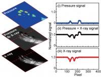 [2021] Multimodal Digital X-ray Scanners with Synchronous Mapping of Tactile Pressure Distributions Using Perovskites