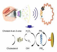 [2022] Wireless Non-invasive Monitoring of Cholesterol Using A Smart Contact Lens