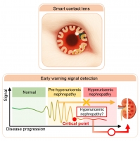 [2026] Tear-Based Dynamic Network Biomarkers for Pre-Disease Detection of Hyperuricemic Nephropathy via Smart Contact Lens