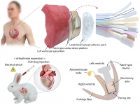 **[2022] In-situ diagnosis and simultaneous treatment of cardiac diseases using a single device platform